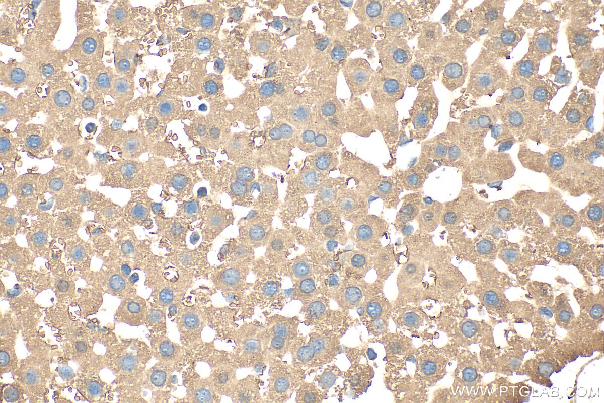 Immunohistochemical analysis of paraffin-embedded mouse liver tissue slide using 27751-1-AP (APOB antibody) at dilution of 1:200 (under 40x lens). Heat mediated antigen retrieval with Tris-EDTA buffer (pH 9.0). Immunohistochemistry (IHC) staining of mouse liver tissue using APOB Polyclonal antibody (27751-1-AP)