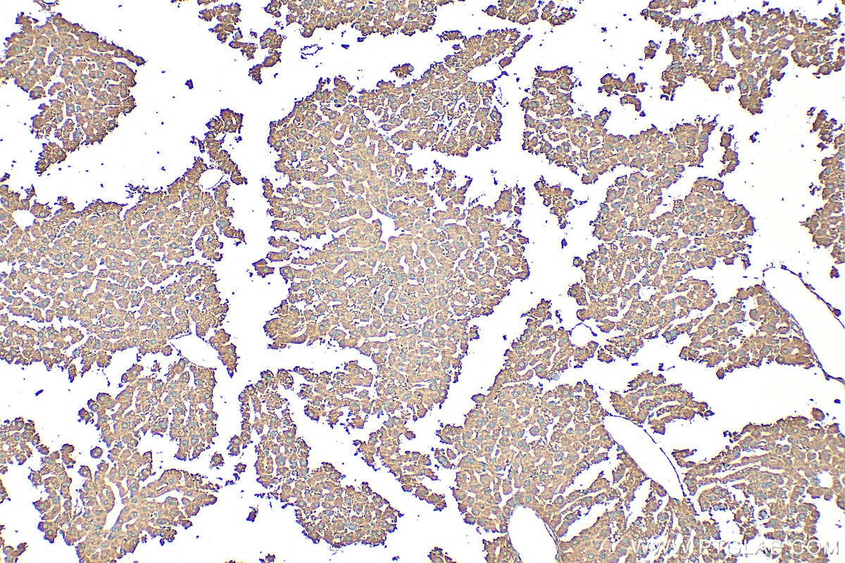 Immunohistochemical analysis of paraffin-embedded mouse liver tissue slide using 27751-1-AP (APOB antibody) at dilution of 1:200 (under 10x lens). Heat mediated antigen retrieval with Tris-EDTA buffer (pH 9.0). Immunohistochemistry (IHC) staining of mouse liver tissue using APOB Polyclonal antibody (27751-1-AP)