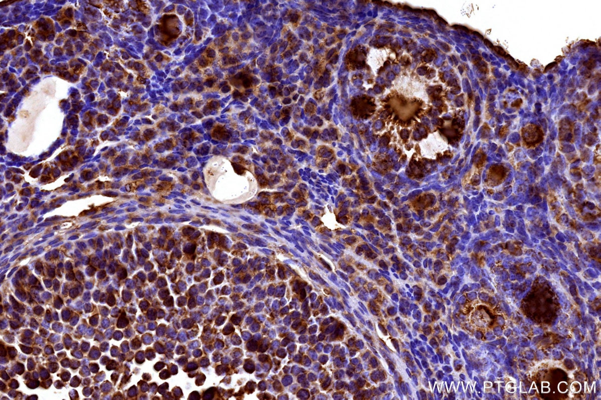 IHC staining of mouse ovary using 27751-1-AP Immunohistochemistry (IHC) staining of mouse ovary tissue using APOB Polyclonal antibody (27751-1-AP)