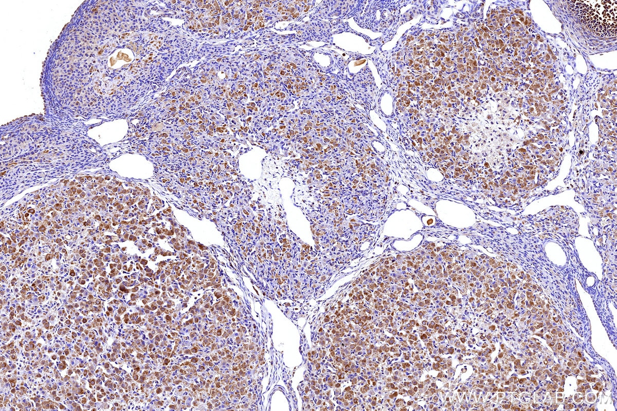 IHC staining of rat ovary using 27751-1-AP Immunohistochemistry (IHC) staining of rat ovary tissue using APOB Polyclonal antibody (27751-1-AP)