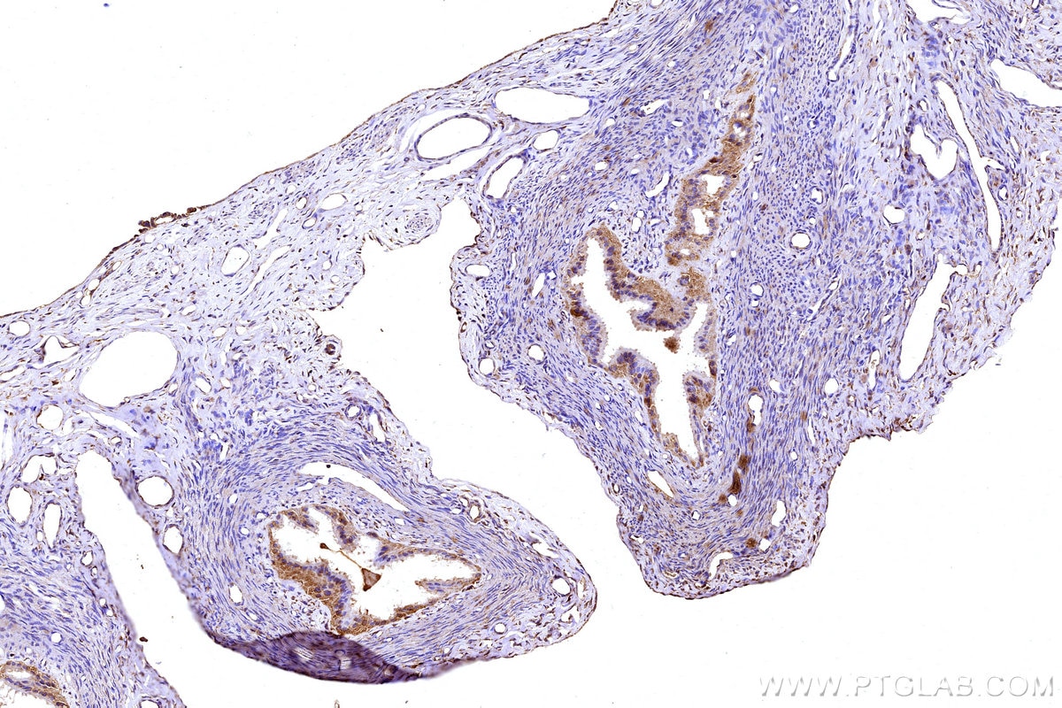 IHC staining of rat ovary using 27751-1-AP Immunohistochemistry (IHC) staining of rat ovary tissue using APOB Polyclonal antibody (27751-1-AP)