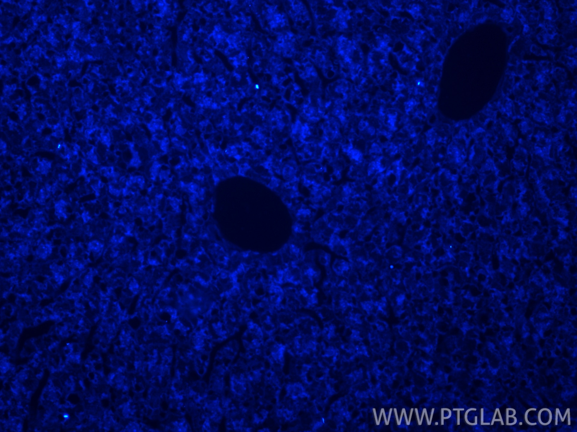 Immunofluorescence (IF) / fluorescent staining of mouse liver tissue using CoraLite® Plus 405-conjugated APOB Recombinant mon (CL405-84047)