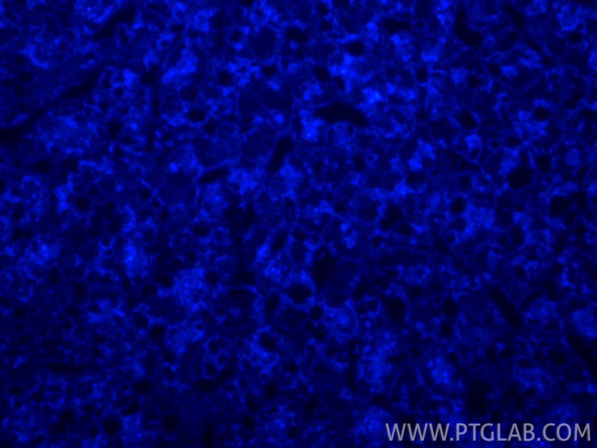 Immunofluorescence (IF) / fluorescent staining of mouse liver tissue using CoraLite® Plus 405-conjugated APOB Recombinant mon (CL405-84047)