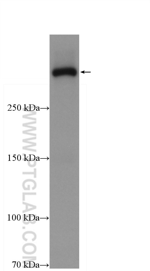 Western Blot (WB) analysis of human plasma using HRP-conjugated APOB Polyclonal antibody (HRP-20578)