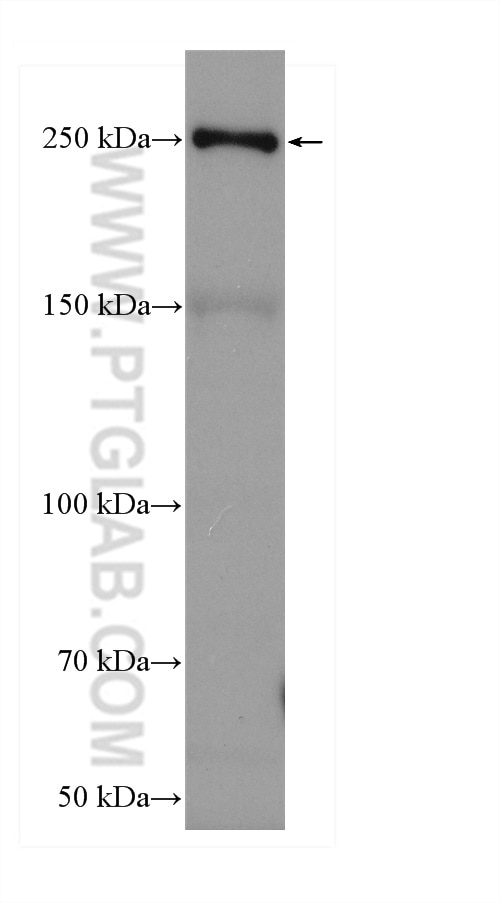 Western Blot (WB) analysis of mouse liver tissue using HRP-conjugated APOB Polyclonal antibody (HRP-20578)