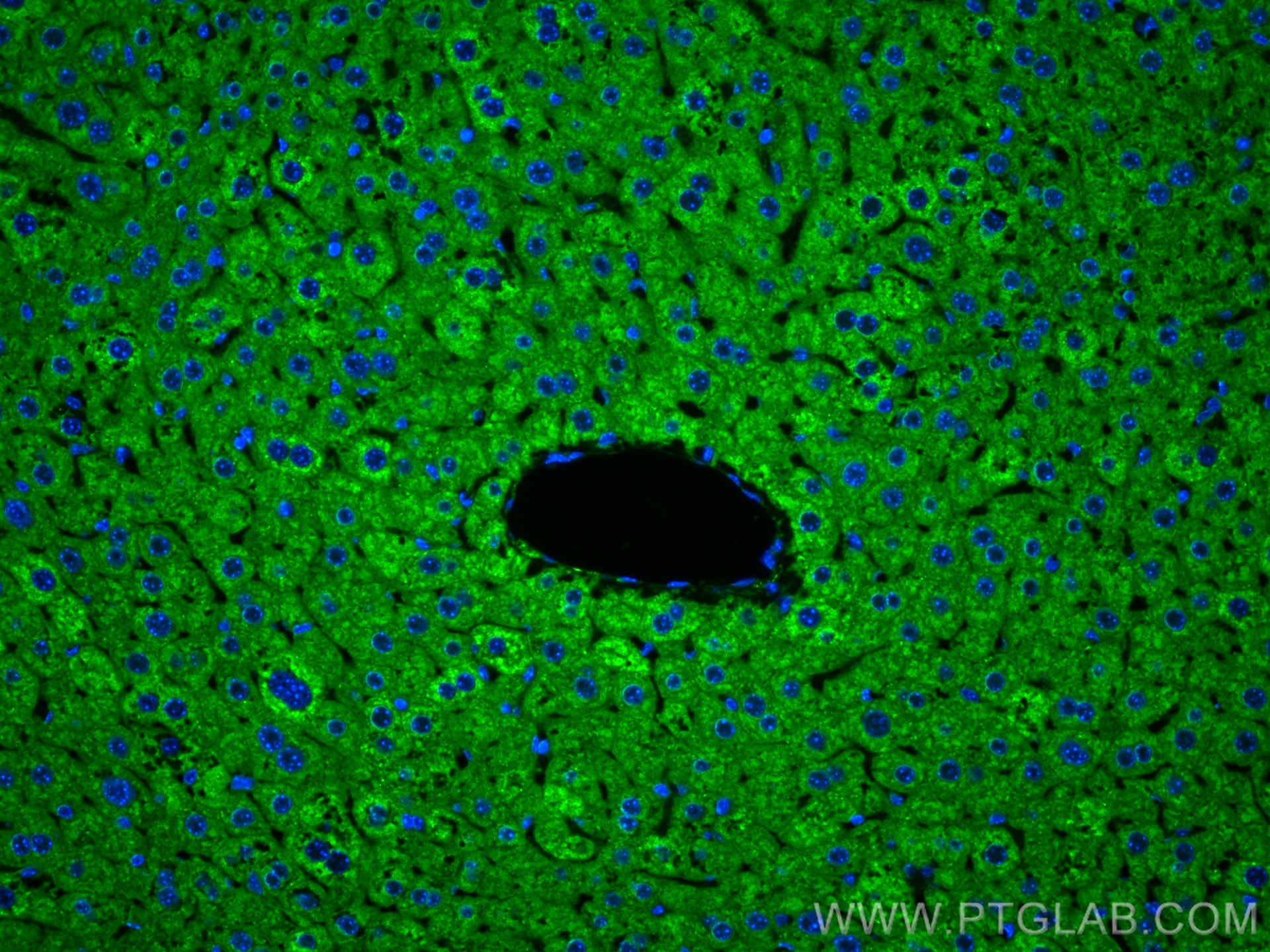 Immunofluorescence (IF) / fluorescent staining of mouse liver tissue using Multi-rAb™ APOB Multi-Recombinant antibody (RMX00011)