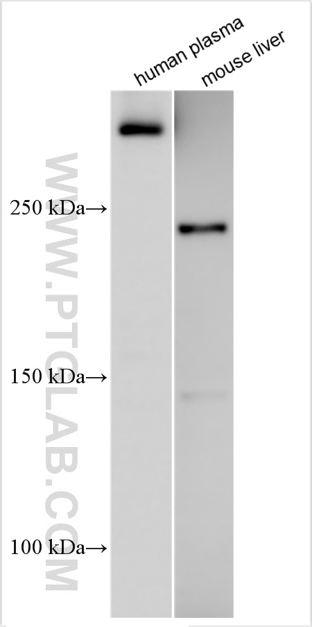 Western Blot (WB) analysis of various lysates using Multi-rAb™ APOB Multi-Recombinant antibody (RMX00011)