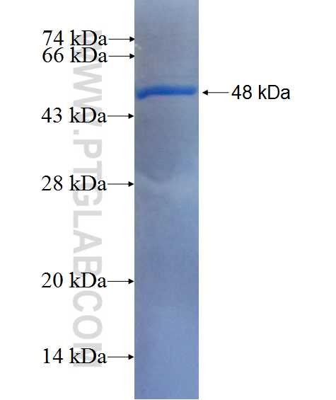 APOB fusion protein Ag26773 SDS-PAGE