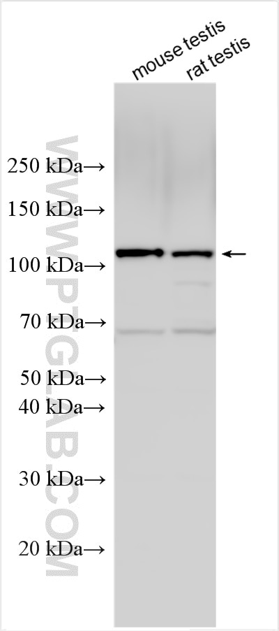 Western Blot (WB) analysis of various lysates using APOB48R Polyclonal antibody (25328-1-AP)