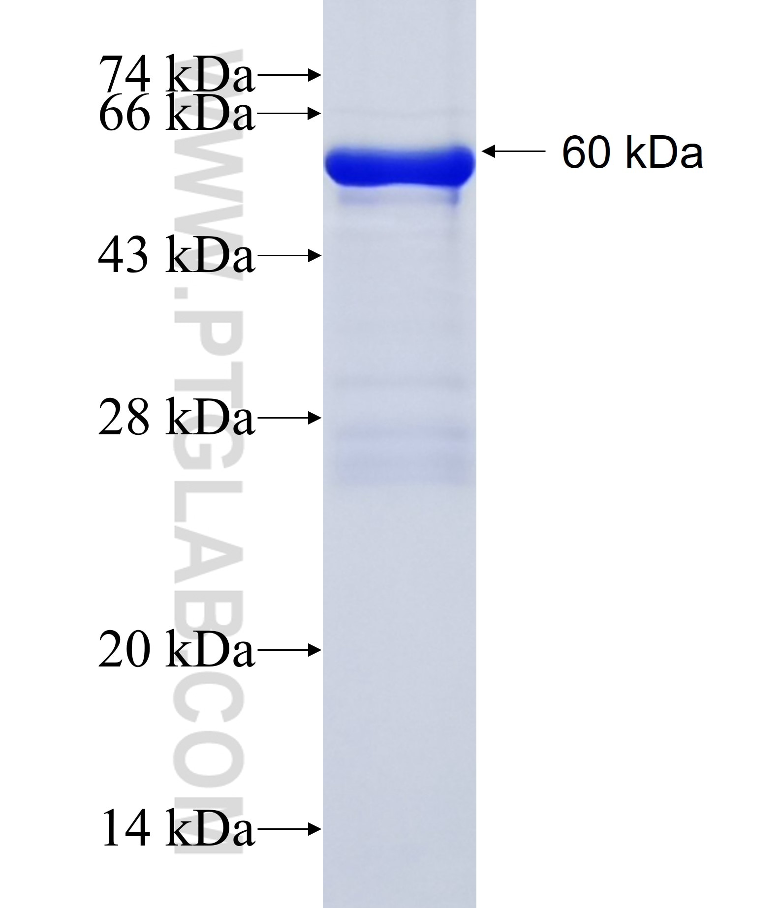 APOB48R fusion protein Ag18204 SDS-PAGE