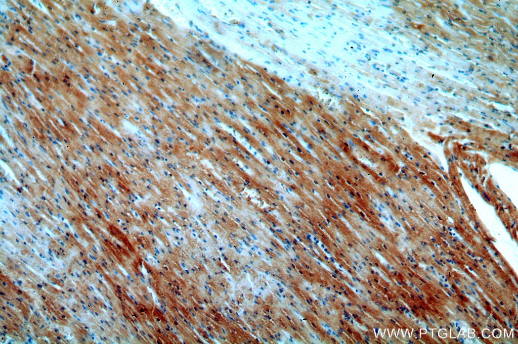 Immunohistochemistry (IHC) staining of human heart tissue using APOBEC2 Polyclonal antibody (20121-1-AP)