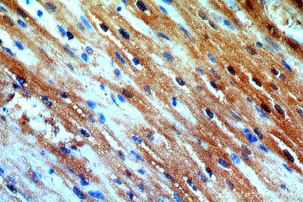 Immunohistochemistry (IHC) staining of human heart tissue using APOBEC2 Polyclonal antibody (20121-1-AP)