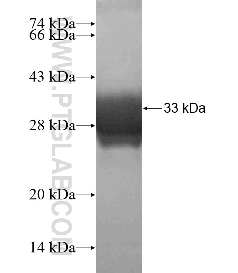 APOBEC3A fusion protein Ag18845 SDS-PAGE
