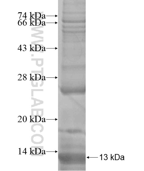 APOBEC3A fusion protein Ag18969 SDS-PAGE APOBEC3A fusion protein Ag18969 SDS-PAGE