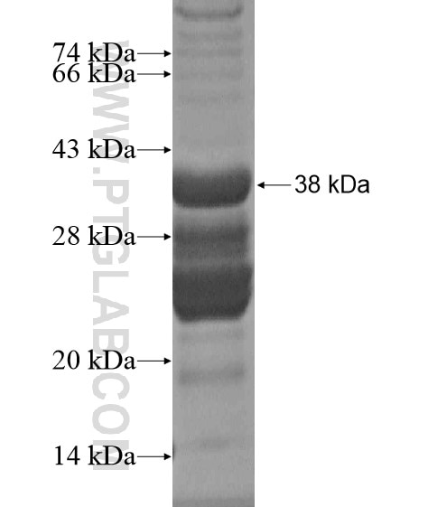 APOBEC3D fusion protein Ag20194 SDS-PAGE