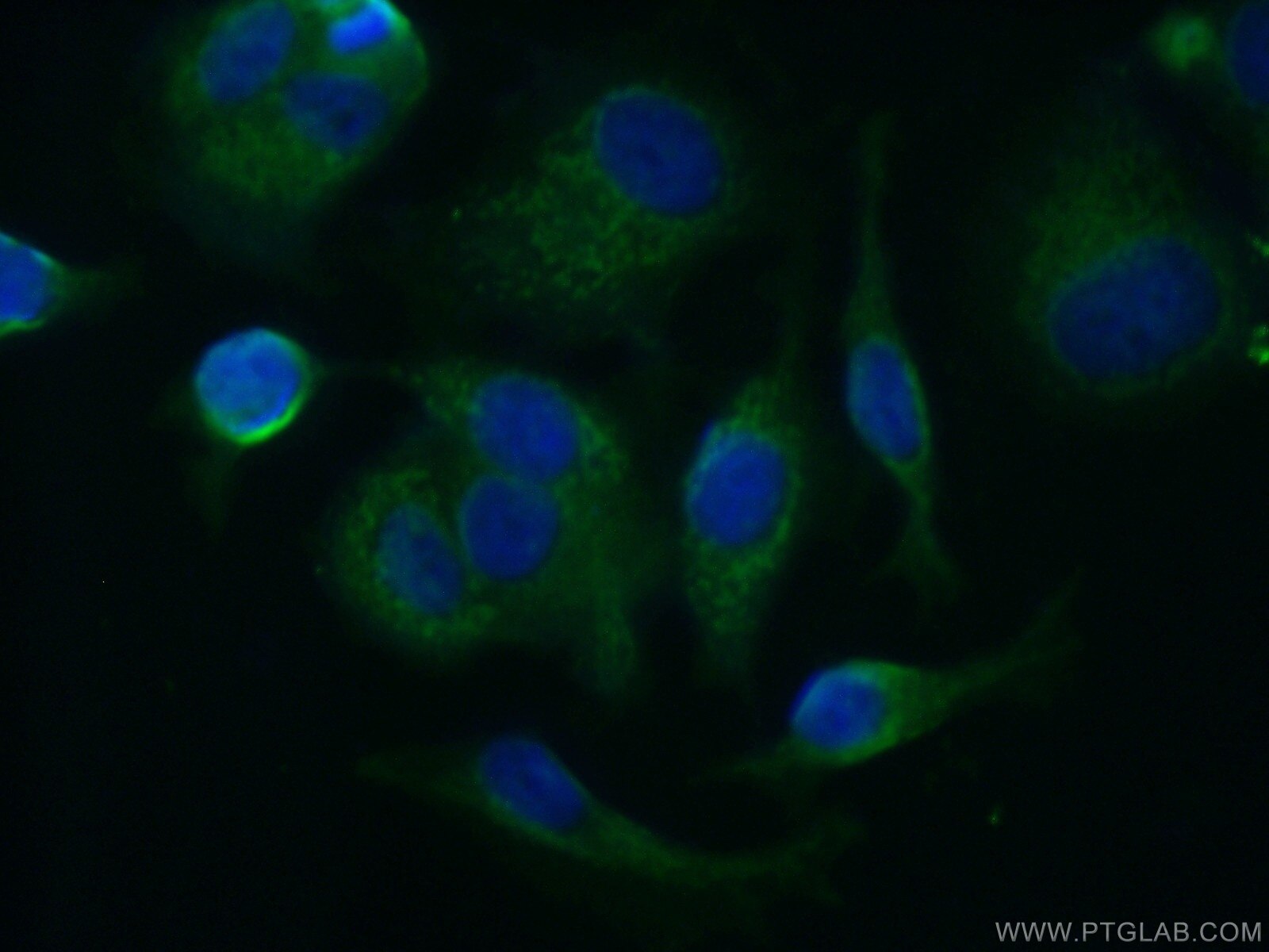 Immunofluorescence (IF) / fluorescent staining of MCF-7 cells using APOBEC3G Polyclonal antibody (10608-1-AP)
