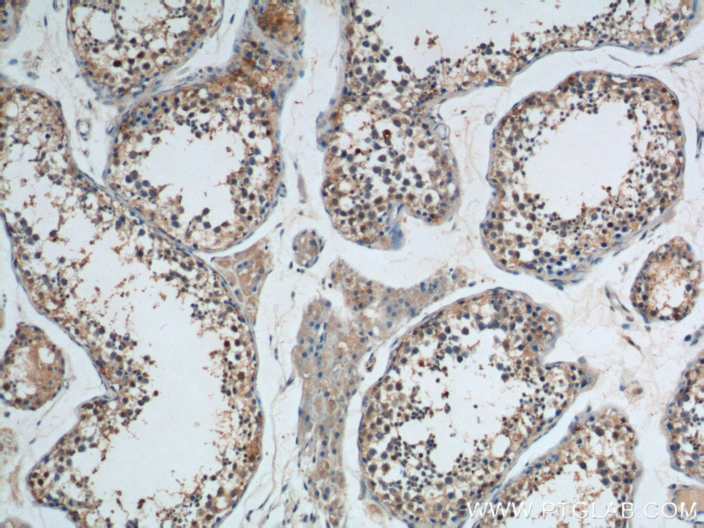 IHC staining of human testis using 10608-1-AP