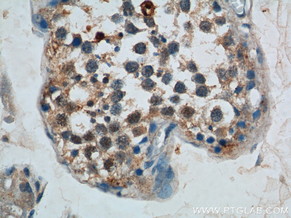 Immunohistochemistry (IHC) staining of human testis tissue using APOBEC3G Polyclonal antibody (10608-1-AP)