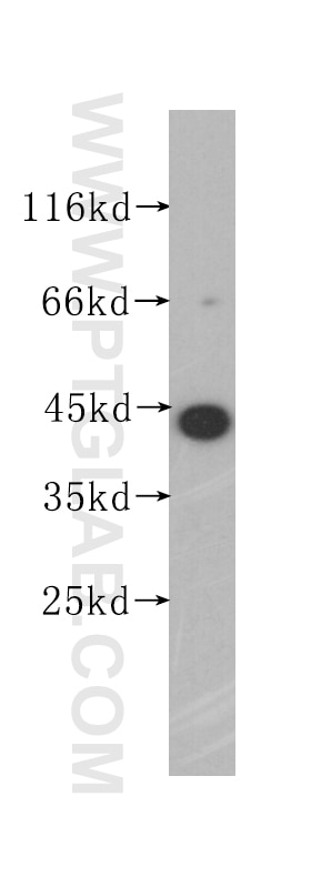 WB analysis of A375 using 60100-1-Ig