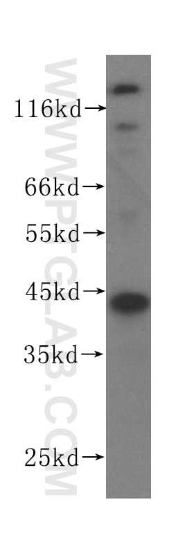 Western Blot (WB) analysis of A375 cells using APOBEC3G Monoclonal antibody (60100-1-Ig)