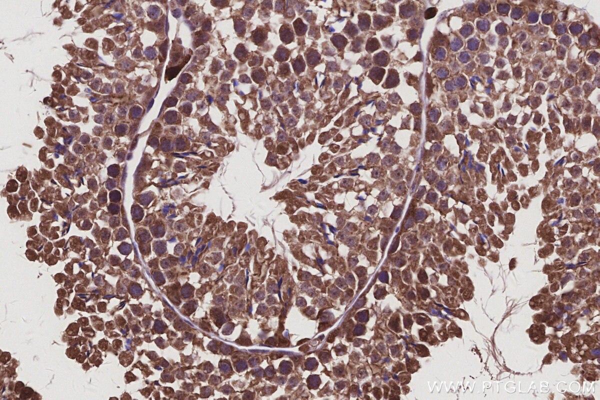 Immunohistochemistry (IHC) staining of mouse testis tissue using APOBEC4 Polyclonal antibody (17166-1-AP)