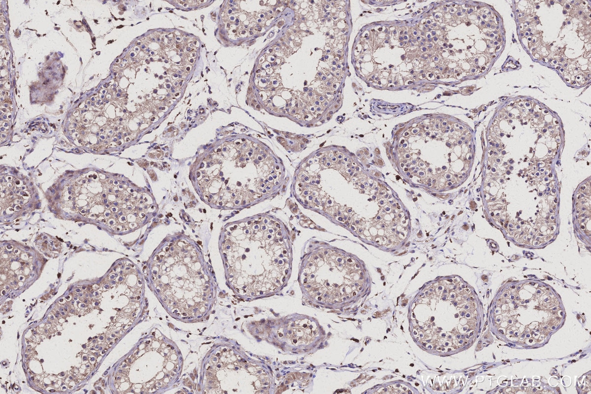 Immunohistochemistry (IHC) staining of human testis tissue using APOBEC4 Polyclonal antibody (17166-1-AP)