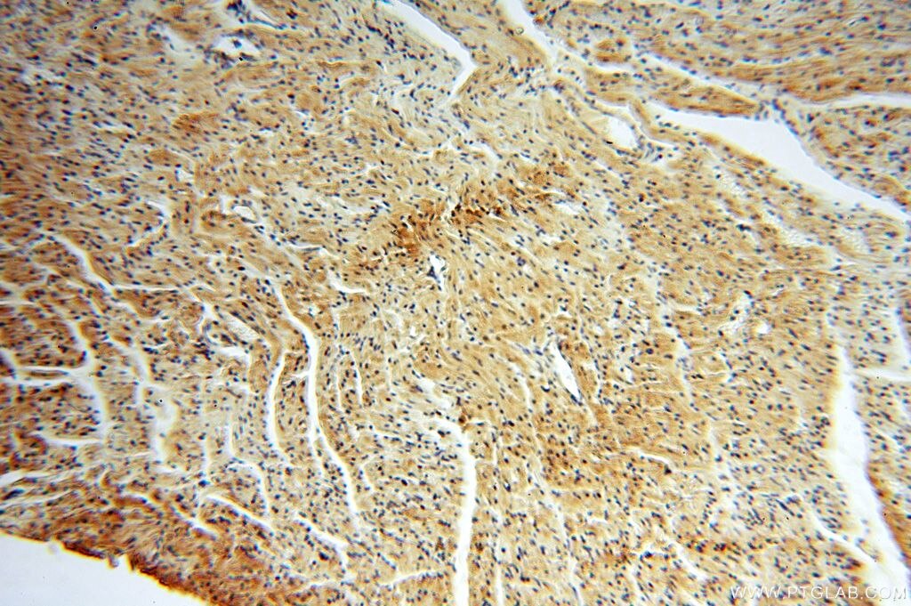 Immunohistochemistry (IHC) staining of human heart tissue using APOBEC4 Polyclonal antibody (17166-1-AP)