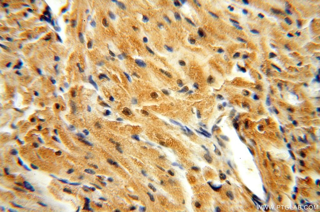 Immunohistochemistry (IHC) staining of human heart tissue using APOBEC4 Polyclonal antibody (17166-1-AP)