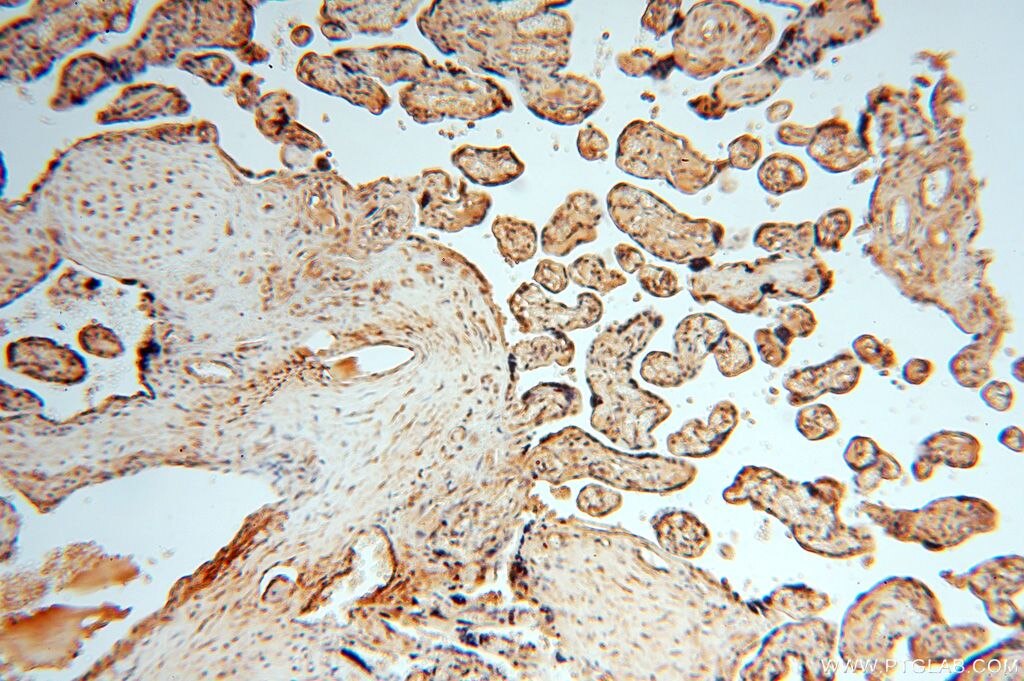 Immunohistochemistry (IHC) staining of human placenta tissue using APOBEC4 Polyclonal antibody (17166-1-AP)