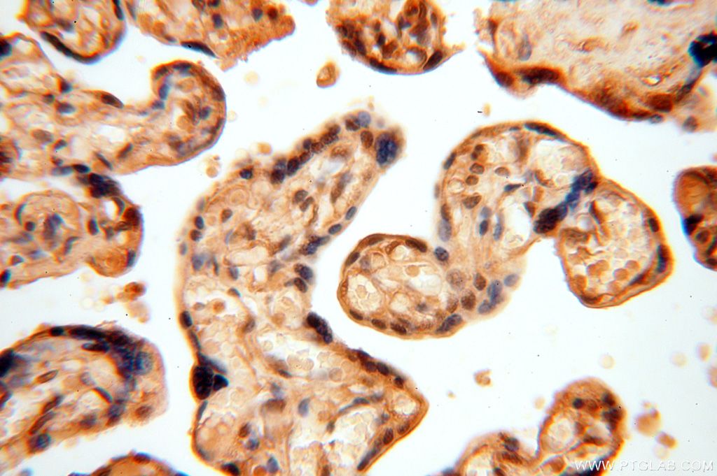 Immunohistochemistry (IHC) staining of human placenta tissue using APOBEC4 Polyclonal antibody (17166-1-AP)