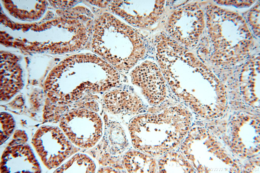 Immunohistochemistry (IHC) staining of human testis tissue using APOBEC4 Polyclonal antibody (17166-1-AP)