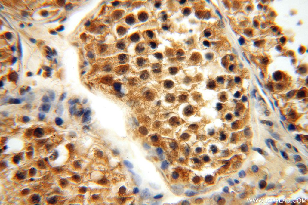 Immunohistochemistry (IHC) staining of human testis tissue using APOBEC4 Polyclonal antibody (17166-1-AP)