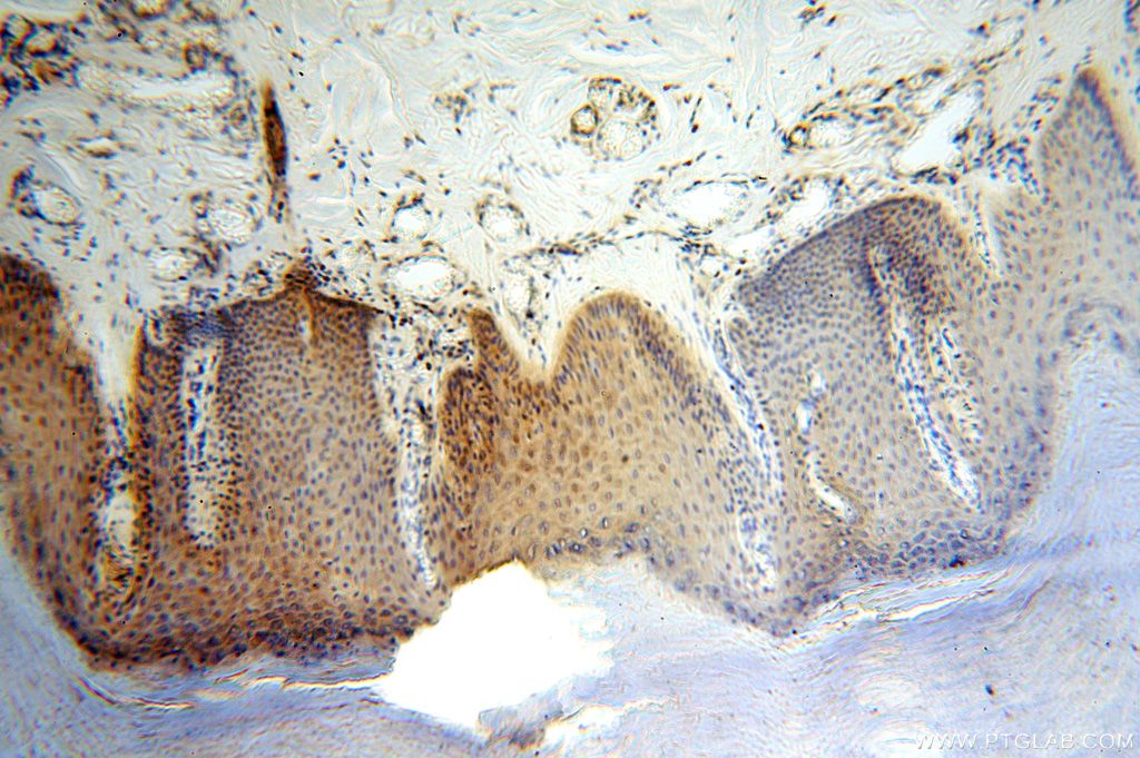 IHC staining of human skin using 17166-1-AP