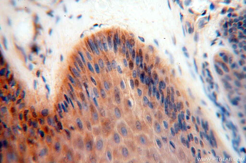 IHC staining of human skin using 17166-1-AP