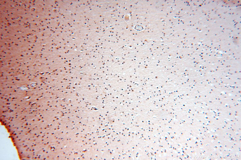 Immunohistochemistry (IHC) staining of human brain tissue using APOBEC4 Polyclonal antibody (17166-1-AP)