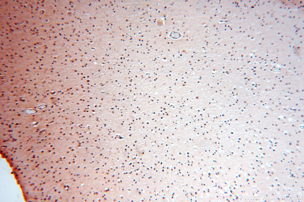 IHC staining of human brain using 17166-1-AP