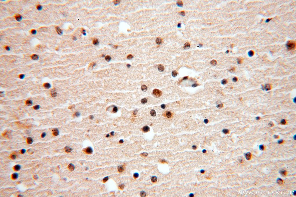 Immunohistochemistry (IHC) staining of human brain tissue using APOBEC4 Polyclonal antibody (17166-1-AP)