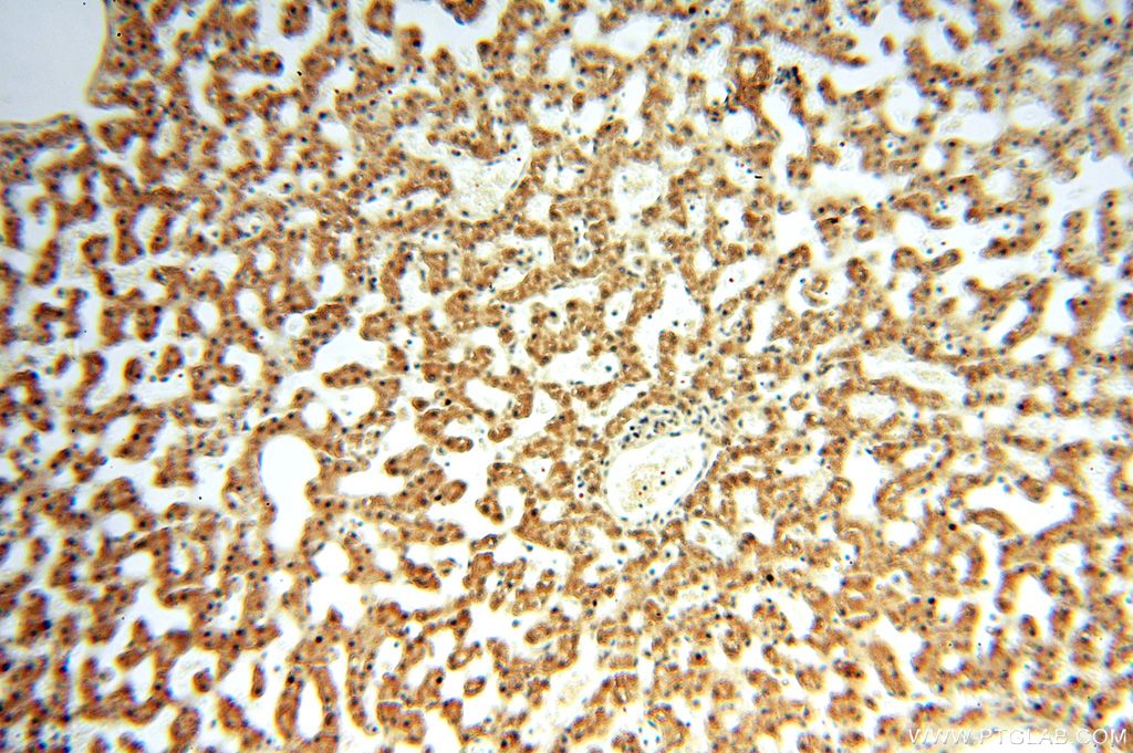 Immunohistochemistry (IHC) staining of human liver tissue using APOBEC4 Polyclonal antibody (17166-1-AP)