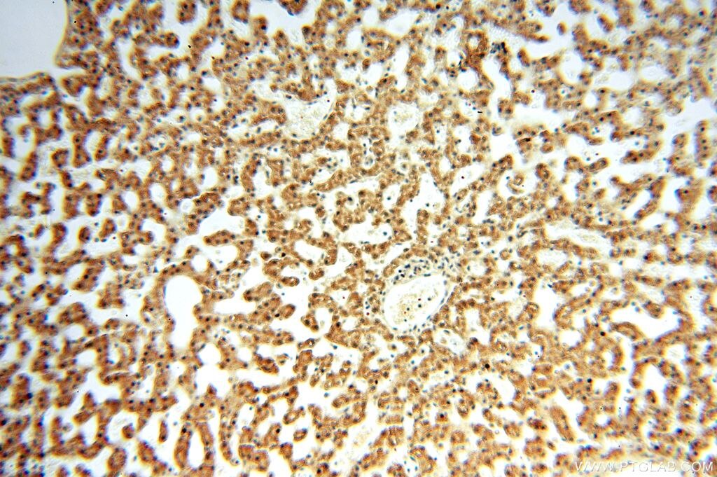 IHC staining of human liver using 17166-1-AP