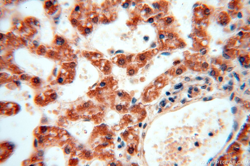 Immunohistochemistry (IHC) staining of human liver tissue using APOBEC4 Polyclonal antibody (17166-1-AP)