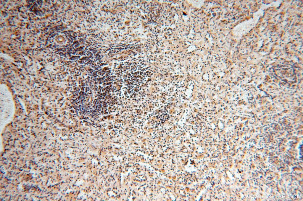 Immunohistochemistry (IHC) staining of human spleen tissue using APOBEC4 Polyclonal antibody (17166-1-AP)