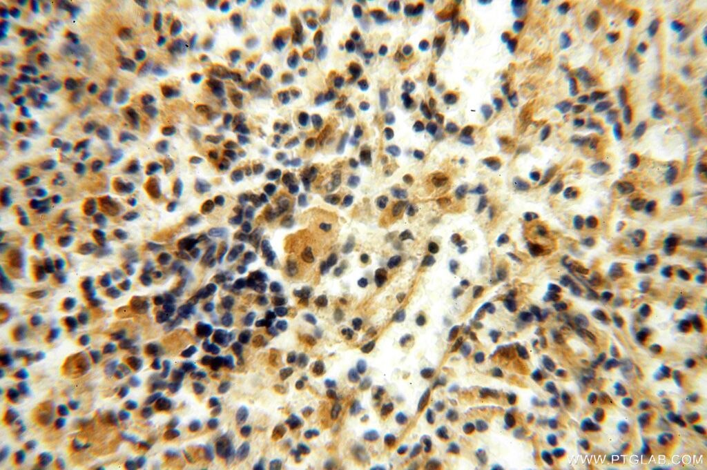 IHC staining of human spleen using 17166-1-AP