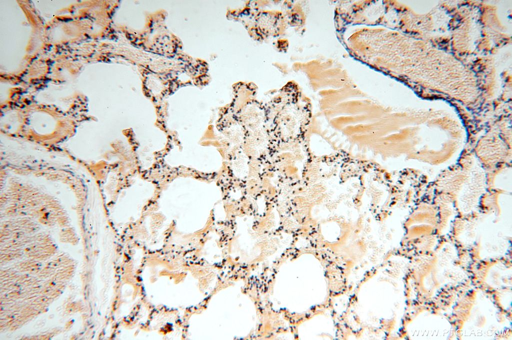 Immunohistochemistry (IHC) staining of human lung tissue using APOBEC4 Polyclonal antibody (17166-1-AP)