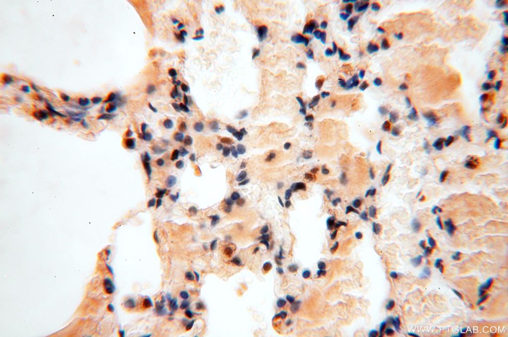 Immunohistochemistry (IHC) staining of human lung tissue using APOBEC4 Polyclonal antibody (17166-1-AP)