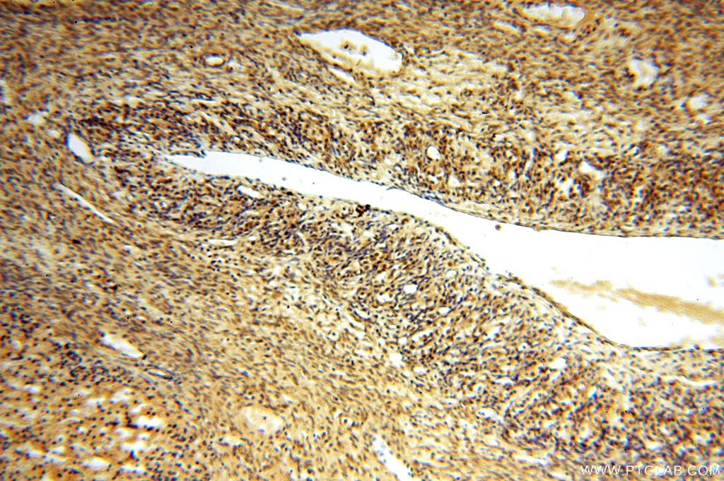 Immunohistochemistry (IHC) staining of human ovary tissue using APOBEC4 Polyclonal antibody (17166-1-AP)