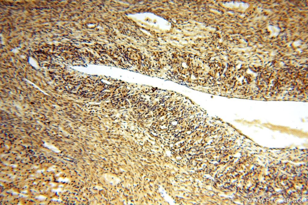 IHC staining of human ovary using 17166-1-AP