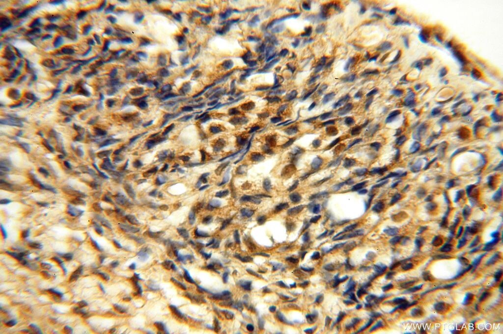 Immunohistochemistry (IHC) staining of human ovary tissue using APOBEC4 Polyclonal antibody (17166-1-AP)