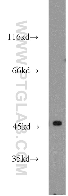 WB analysis of HeLa using 17166-1-AP