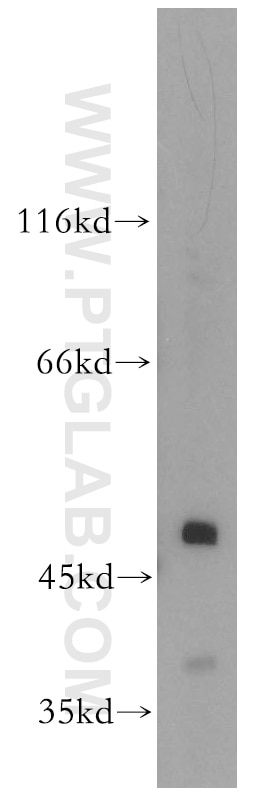Western Blot (WB) analysis of HeLa cells using APOBEC4 Polyclonal antibody (17166-1-AP)