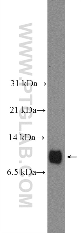 Western Blot (WB) analysis of human plasma using APOC2 Polyclonal antibody (27045-1-AP)